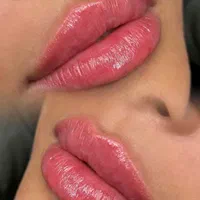 آموزش تزریق فیلر،بوتاکس و لیزر توسط پزشک|خدمات آموزشی|آمل, |دیوار