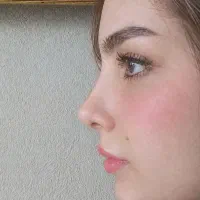 عمل بینی ویژه مراجعین بناب/۵۰تومن/در تهران/ent