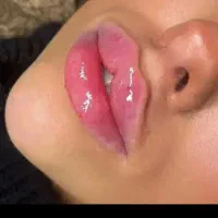 جشنواره ژل بوتاکس ۵۰%کلینبک ماهرخ