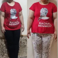 لاغری بدون رژیم