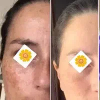 جشنواره آخر ماه«آف ویژه» پوست زیبابیوممتیک