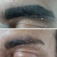 پاک کردن تخصصی تاتو بدون موندن جایی تخفیف محرم
