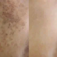 جشنواره تخفیف خدمات پوستی(فیشال،پاکسازی،کربوکسی)|خدمات آرایشگری و زیبایی|بیرجند, |دیوار