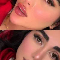 تزریق فیلر و فیلر بادی پی ار پی مزو توسط پزشک