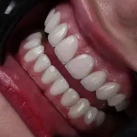 کلینیک دندان پزشکی ولابراتوار دندان دولابی بااقساط