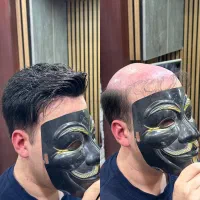 پروتزمو قم|خدمات آرایشگری و زیبایی|قم, زاد|دیوار