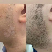 توی یه دوره از بین ببرین