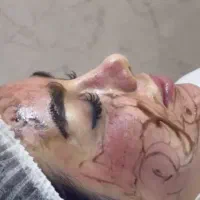 درمان تخصصی لک  جشنواره تخفیف به مناسبت روز پدر