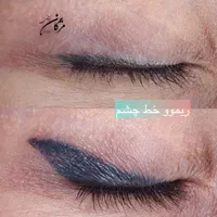 ریموو و پاک‌کردن تخصصی تاتو (تتو) ابرو بدون لیزر|خدمات آرایشگری و زیبایی|شیراز, معالی‌آباد|دیوار