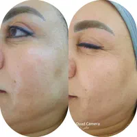 آموزش و خدمات پوست و فیشال|خدمات آرایشگری و زیبایی|مشهد, هفده شهریور|دیوار