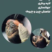 رفع تیرگی بدن  و لیزر تتوهای قدیمی بدن و صورت|خدمات آرایشگری و زیبایی|یاسوج, |دیوار