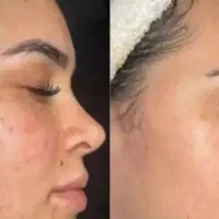 اموزش تخصصی استخدام فشیال وپاکسازی