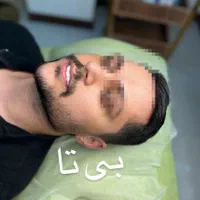 کلیه خدمات درکلینیک ازسیسی480|خدمات آرایشگری و زیبایی|نسیمشهر, |دیوار