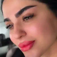 تخفیف ویژه فقط تا پنج روز .ژل فیلر فقط ۸۵۰