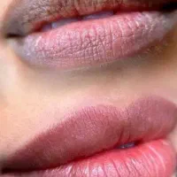 انجام خدمات تخصصی‌ شیدینگ لب (رفع تیرگی لب)