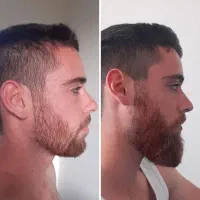 ریشتو دست کم نگیر