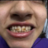 آموزش تخصصی دندانسازی و بلیچینگ و کامپوزیت|خدمات آموزشی|شیراز, معالیآباد|دیوار