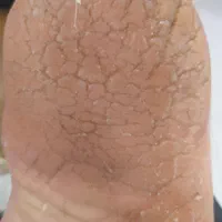 پدیکور
