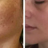 لاکچری کوین