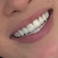 دندانپزشکی بامناسب‌ترین قیمت ایمپلنت درمانی زیبایی|خدمات آرایشگری و زیبایی|تهران, فلسطین (میدان انقلاب)|دیوار