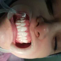 استخدام در مطب دندانپزشکی