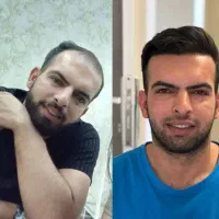 کاشت مو/کاشتمو/کاشت ریش یک مرحله ای|خدمات آرایشگری و زیبایی|نجفآباد, باغ ملی|دیوار