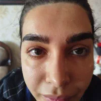 ژل بوتاکس مزو|خدمات آرایشگری و زیبایی|صدرا-فارس, فاز ۱|دیوار