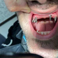 دندانپزشکی/ترمیم/کامپوزیت/لمینیت/عصبکشی قسطی|خدمات آرایشگری و زیبایی|مشهد, سجاد شهر|دیوار