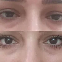 ریمل گیاهی .از همه ی آگهی هام دیدن فرمایید