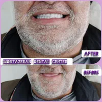 دندان مصنوعی/ ضمانتی / ایتالیایی/ جوان پسند|خدمات آرایشگری و زیبایی|مشهد, امام رضا (ع)|دیوار