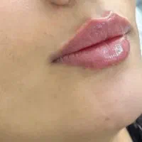 تزریق ژل وبوتاکس باموادکره ای وفرانسه،فشیال،تتو|خدمات آرایشگری و زیبایی|تبریز, |دیوار