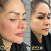 کلینیک زیبایی و مرکز لیزر دژآباد در رودسر