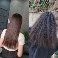 بوتاکس با هر قد مویی۳تومان