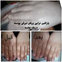 رفع تیرگی قوزک پا درمان ترک پا  پارافین درمانی|خدمات آرایشگری و زیبایی|بروجرد, |دیوار