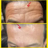 کرم۵ کاره بیوممتیک(پرداخت درب منزل)