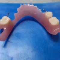 ساخت دست دندان کامل وفلیپر