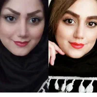 حذف تتو،کک و مک،ماه گرفتگی و روشن سازی بدن با لیزر|خدمات آرایشگری و زیبایی|قزوین, |دیوار