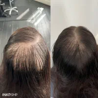 با کم پشتی برای همیشه خداحافظی کن