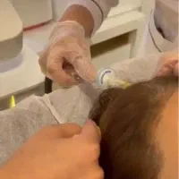 خدمات زیبایی و کربوکسی تراپی و خال