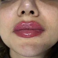 کلینیک تخصصی پوست،مو و زیبایی دکتر فاطمه عروجی|خدمات آرایشگری و زیبایی|تهران, مشیریه|دیوار