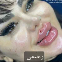 تزریق (ژل،بوتاکس،نخ)قیمت مناسب|خدمات آرایشگری و زیبایی|ملارد, |دیوار