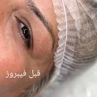 مژده مژده  فیبروز ابرو رایگان