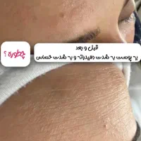 پاکسازی پوست با تخفیف ویژه|خدمات آرایشگری و زیبایی|رشت, استقامت ۱|دیوار