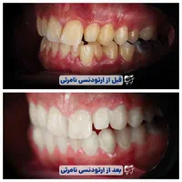 ارتودنسی نامرئی بدون سیم بدون درد - رایگان|خدمات آرایشگری و زیبایی|شیراز, نیایش|دیوار