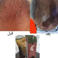 زیبایی از آریا شروع میشه حس رضایتی که از اول|آرایشی، بهداشتی، درمانی|اراک, |دیوار