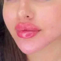 مزوژل آنزیم چربی اگزوزوم بادی بایوفیلر لیفت ژل ۴۹۰