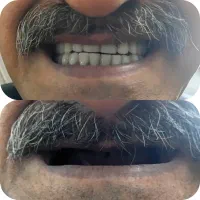 لابراتور دندان سازی آریا ( یزد )