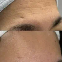 فشیال و پاکسازی پوست تخصصی و کلینیکال|خدمات آرایشگری و زیبایی|سبزوار, ولیعصر (نجار آباد)|دیوار