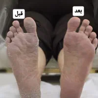 پدیکور و کفسابی-کاشت و ترمیم و ژلیش-لمینت|خدمات آرایشگری و زیبایی|کرج, اتحاد|دیوار