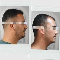 محصول معجزه اسا رویش مجددمو و ضدریزش در 83 روز|آرایشی، بهداشتی، درمانی|تهران, سعادت‌آباد|دیوار